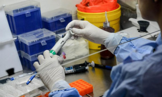 Domingo (16): Mato Grosso registra 382.621 casos e 10.420 óbitos por Covid-19