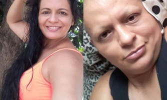 'Faça o autoexame', alerta mulher que descobriu câncer avançado após médico apontar gordura e mandar ela emagrecer em MT
