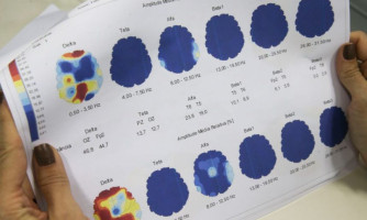 Março Roxo quer conscientizar população sobre a epilepsia