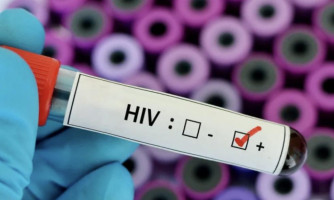 MT registra 316 novos casos de Aids entre janeiro e outubro de 2024