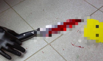Homem é esfaqueado em bar de Conquista D’Oeste e suspeito foge após a agressão