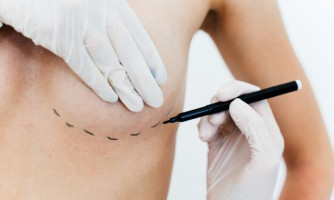Nova lei amplia acesso a cirurgia reparadora de mama e apoio psicológico no SUS e em planos de saúde