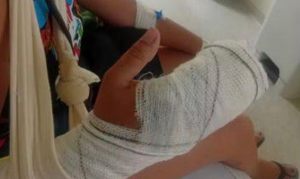 Homem é preso após cortar dedos de ex-namorada em frente aos filhos em MT