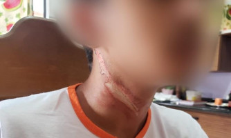 Cabo de internet suspenso na rua derruba motociclista e quase degola adolescente