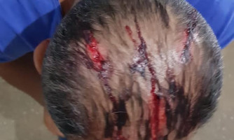Menores são apreendidos por tentativa de homicídio contra homossexual