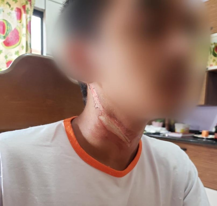 Cabo de internet suspenso na rua derruba motociclista e quase degola adolescente