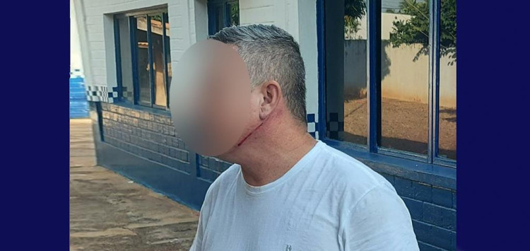 Em briga de bar homem é agredido com taco de sinuca