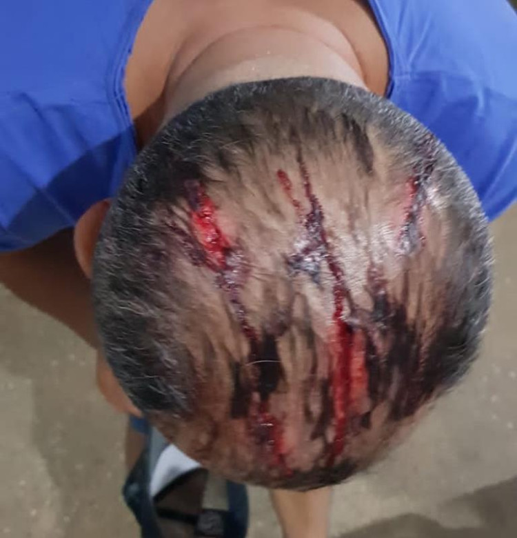 Menores são apreendidos por tentativa de homicídio contra homossexual
