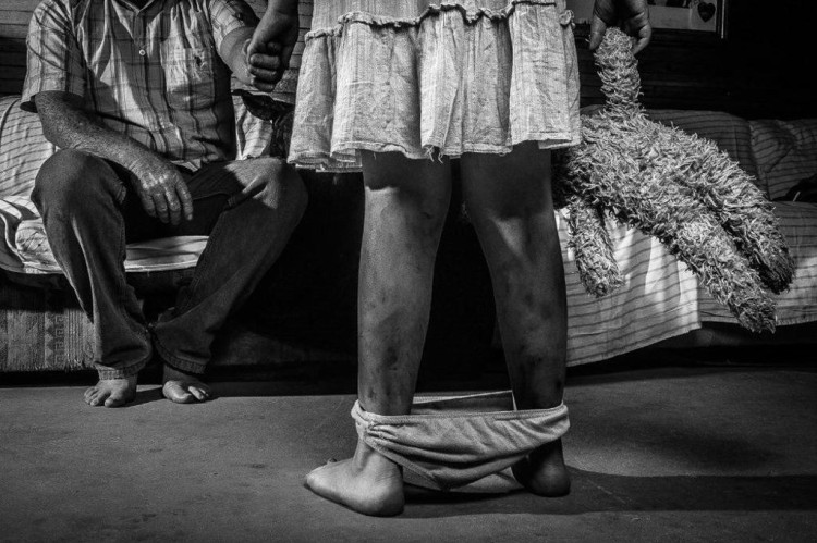 Pontes e Lacerda teve aumento de 48% em casos de violência sexual na infância e adolescência