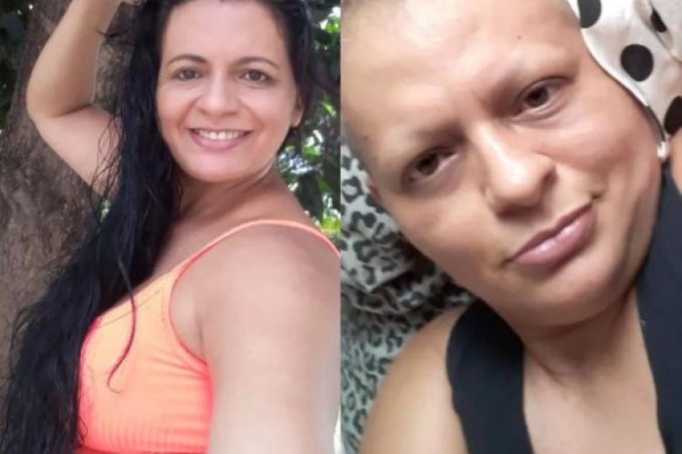 'Faça o autoexame', alerta mulher que descobriu câncer avançado após médico apontar gordura e mandar ela emagrecer em MT